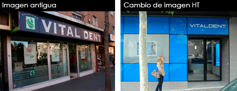 vitaldent_antes_despues2 vitaldent_antes_despues2